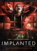İmplant